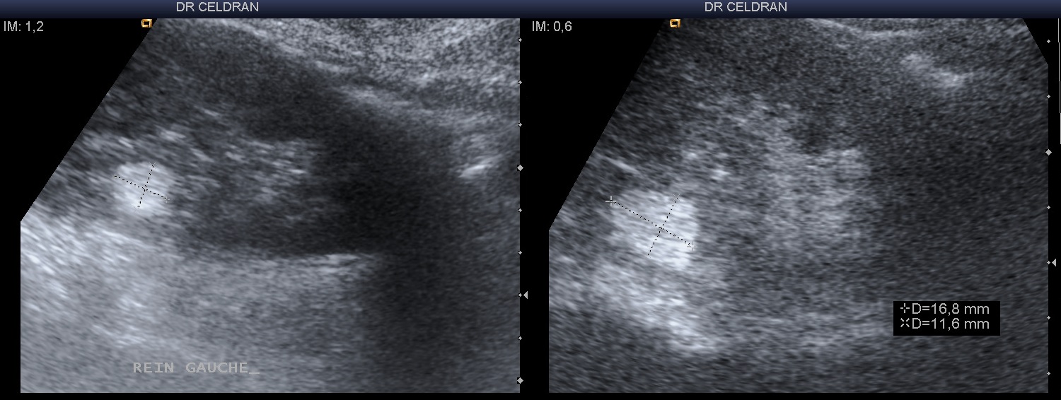 Uro13